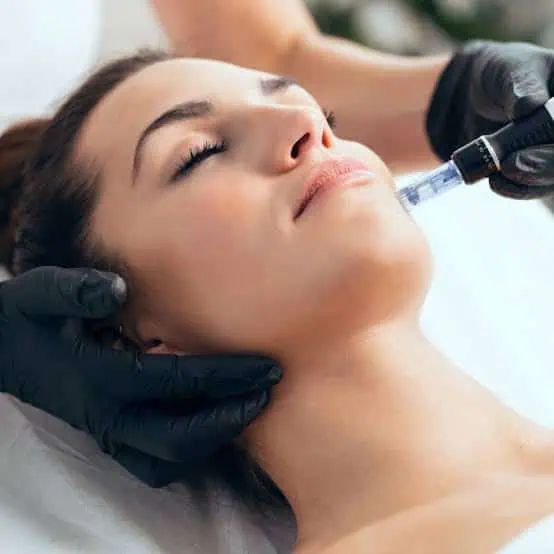 microneedling ares skin boosters