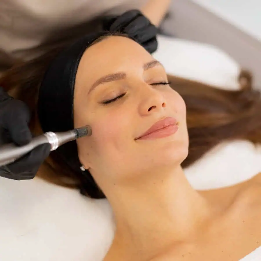 microneedling ares skin boosters